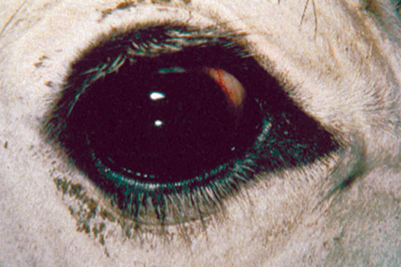 A healthy eye without pinkeye bacteria.
