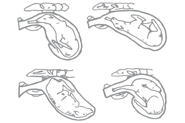 Abnormal positions of the calf