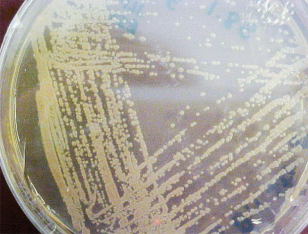 Pseudomonas florescens applied to agar in Petri dish